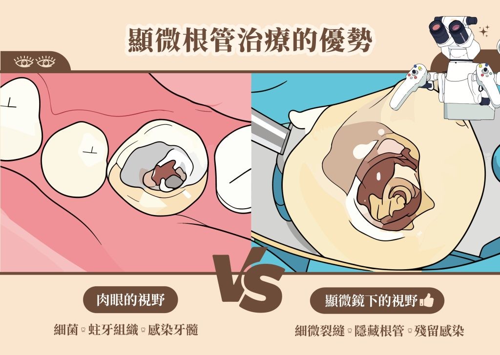 深圳鵬程口腔 | 顯微根管治療 | 價格表