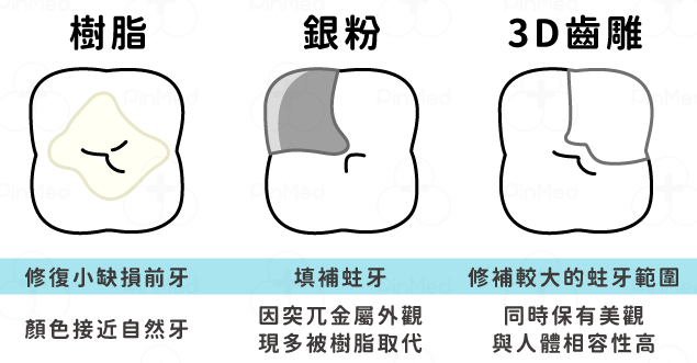 深圳補牙材料有什麼分別？樹脂｜玻璃離子｜嵌體｜鵬程口腔港人參考