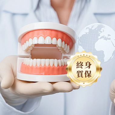 品牌植牙終身質保